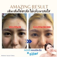 Helene Seoul Clinic ลาดพร้าว 71 นาคนิวาส 13