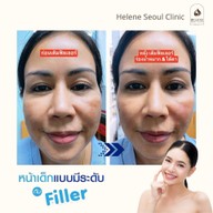 Helene Seoul Clinic ลาดพร้าว 71 นาคนิวาส 13