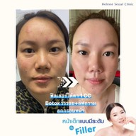 Helene Seoul Clinic ลาดพร้าว 71 นาคนิวาส 13