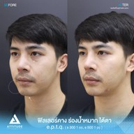 เมนูของร้าน ATTITUDE CLINIC เชียงใหม่