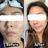 DSCLINIC ไพร์มสแควร์ อุดรธานี