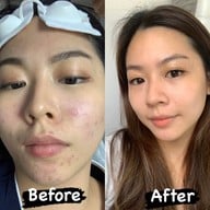 DSCLINIC ไพร์มสแควร์ อุดรธานี
