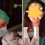 นวดหน้ายกกระชับ Face wellness สอนนวดหน้าเรียว