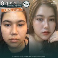 เมนู Everglow clinic ฉะเชิงเทรา