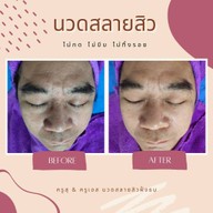 ครูสุครูเอสนวดหน้าละลายสิวฝั่งธน บางแค-เพชรเกษม68 / ชลบุรี /ชะอำ