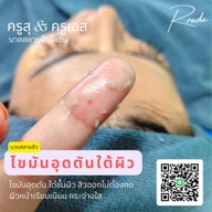 ครูสุครูเอสนวดหน้าละลายสิวฝั่งธน บางแค-เพชรเกษม68 / ชลบุรี /ชะอำ