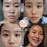 คลีโอ สกิน  Cleo Skin  แม่สาย Maesai