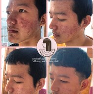 คลีโอ สกิน  Cleo Skin  แม่สาย Maesai