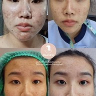 คลีโอ สกิน  Cleo Skin  แม่สาย Maesai