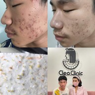 คลีโอ สกิน  Cleo Skin  แม่สาย Maesai