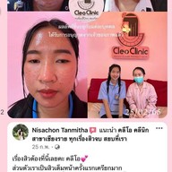 คลีโอ สกิน  Cleo Skin  แม่สาย Maesai
