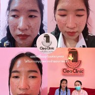 คลีโอ สกิน  Cleo Skin  แม่สาย Maesai