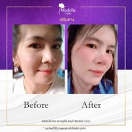 เมนูของร้าน โมเดลล่าคลินิก (Modella Clinic) ปราจีนบุรี