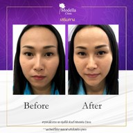 เมนูของร้าน โมเดลล่าคลินิก (Modella Clinic) ปราจีนบุรี