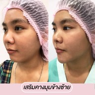 เมนูของร้าน โมเดลล่าคลินิก (Modella Clinic) ปราจีนบุรี