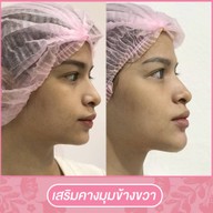 เมนูของร้าน โมเดลล่าคลินิก (Modella Clinic) ปราจีนบุรี