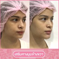 เมนูของร้าน โมเดลล่าคลินิก (Modella Clinic) ปราจีนบุรี