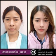 เมนูของร้าน โมเดลล่าคลินิก (Modella Clinic) ปราจีนบุรี