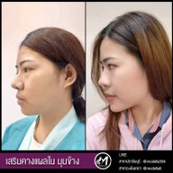 เมนูของร้าน โมเดลล่าคลินิก (Modella Clinic) ปราจีนบุรี