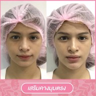 เมนูของร้าน โมเดลล่าคลินิก (Modella Clinic) ปราจีนบุรี