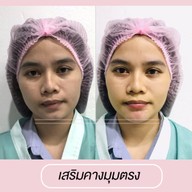 เมนูของร้าน โมเดลล่าคลินิก (Modella Clinic) ปราจีนบุรี