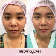 เมนูของร้าน โมเดลล่าคลินิก (Modella Clinic) ปราจีนบุรี