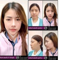 เมนูของร้าน โมเดลล่าคลินิก (Modella Clinic) ปราจีนบุรี