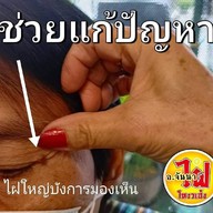อาจารย์จันนาชลบุรี กำจัดไฝตามโหงวเฮ้ง ขี้แมลงวัน ติ่งเนื้อ เลเซอร์ สมุนไพร สี่แยกพลับพลา เสม็ดชลบุรี