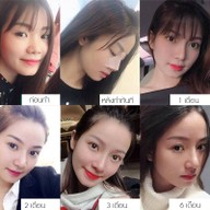 เมนูของร้าน โมเดลล่าคลินิก (Modella Clinic) ปราจีนบุรี