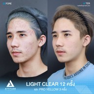 เมนูของร้าน Attitude Clinic  ห้วยขวาง