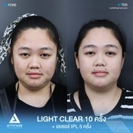 เมนูของร้าน Attitude Clinic  ห้วยขวาง