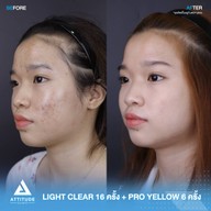 เมนูของร้าน Attitude Clinic  ห้วยขวาง