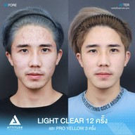 เมนูของร้าน Attitude Clinic  ห้วยขวาง