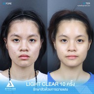 เมนูของร้าน Attitude Clinic  ห้วยขวาง