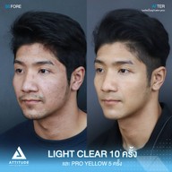 เมนูของร้าน Attitude Clinic  ห้วยขวาง