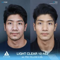 เมนูของร้าน Attitude Clinic  ห้วยขวาง