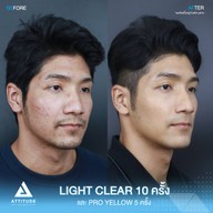 เมนูของร้าน Attitude Clinic  ห้วยขวาง