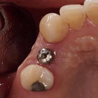 MS Dental Clinic สุขุมวิท39