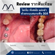 MS Dental Clinic สุขุมวิท39
