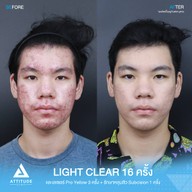 เมนูของร้าน Attitude Clinic  ห้วยขวาง