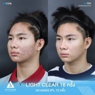 เมนูของร้าน Attitude Clinic  ห้วยขวาง