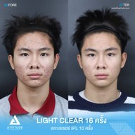 เมนูของร้าน Attitude Clinic  ห้วยขวาง