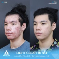 เมนูของร้าน Attitude Clinic  ห้วยขวาง