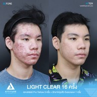 เมนูของร้าน Attitude Clinic  ห้วยขวาง