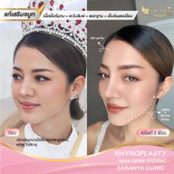 หน้าร้าน สรัญญาคลินิก งามวงศ์วาน