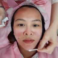 เมนูของร้าน De LUNA Clinic ศรีนครินทร์