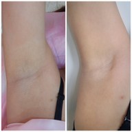 เมนูของร้าน De LUNA Clinic ศรีนครินทร์