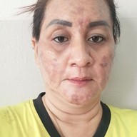 สัมติการแพทย์