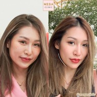 สาวๆจะขึ้นเลข 3 ก็ดูแลตัวเองด้วย💁🏻
Thermage ไปเลยสิคะ สวยยกกระชับลงลึกขั้นกว่