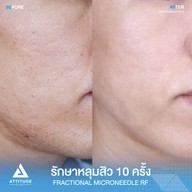 เมนูของร้าน Attitude Clinic  ห้วยขวาง